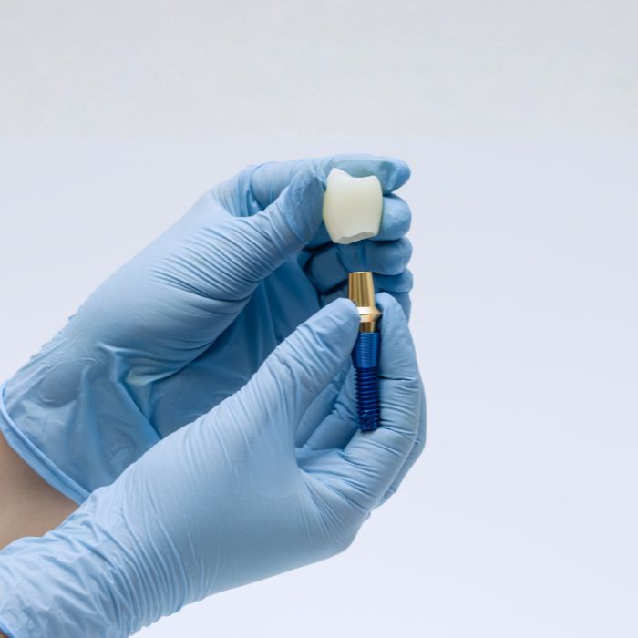 Ciclo Formativo de Grado Superior en Prótesis Dental